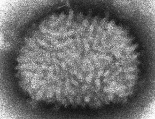 virus Vaccinia
